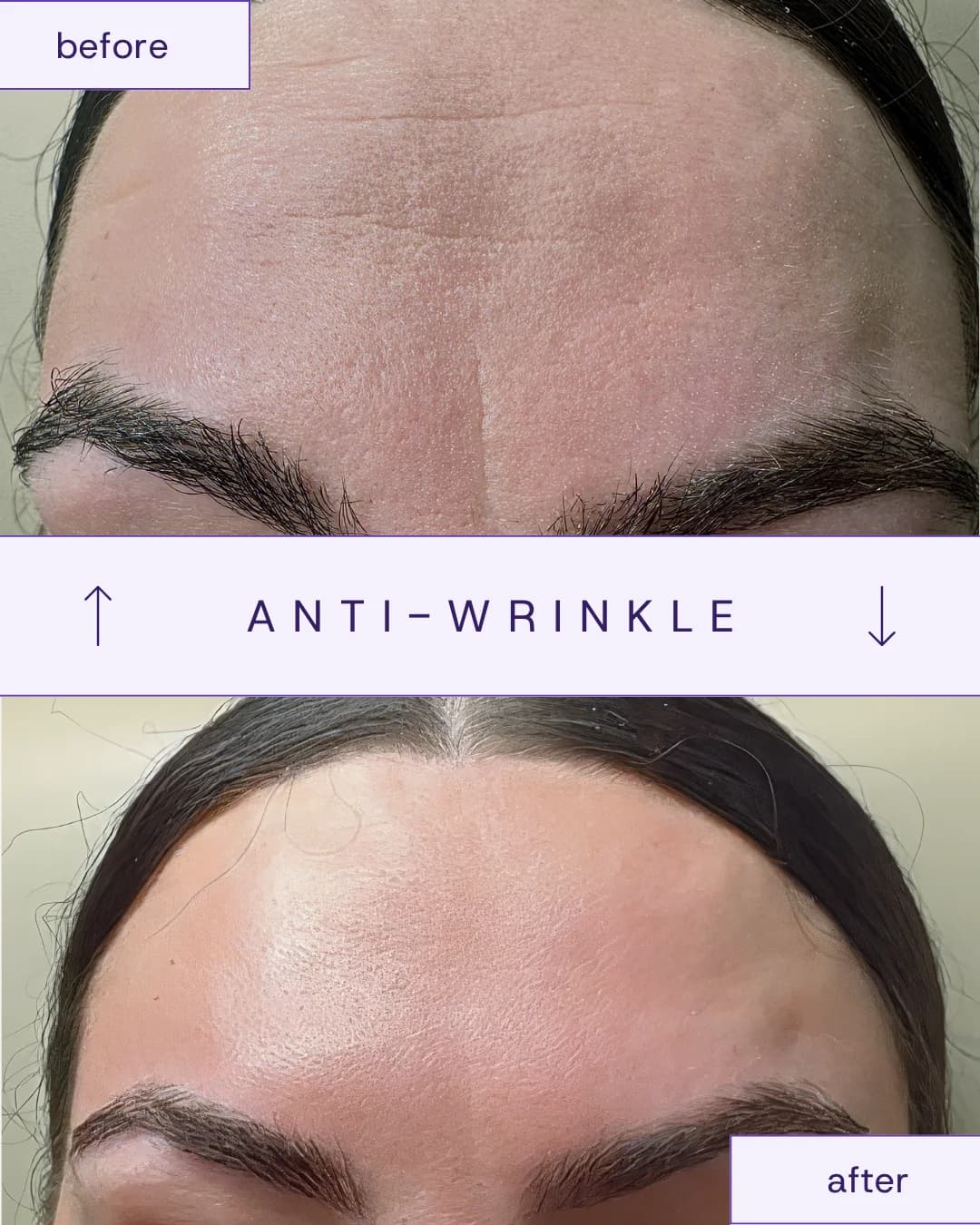 Treatment result