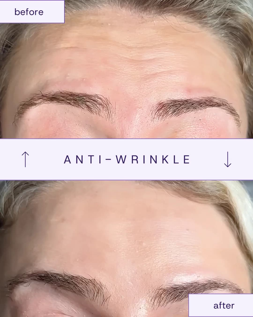 Treatment result