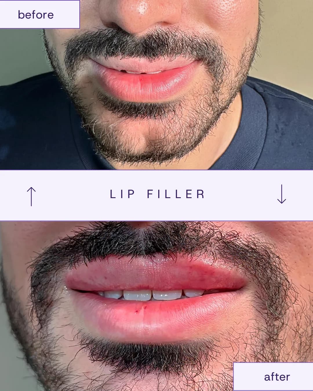Treatment result