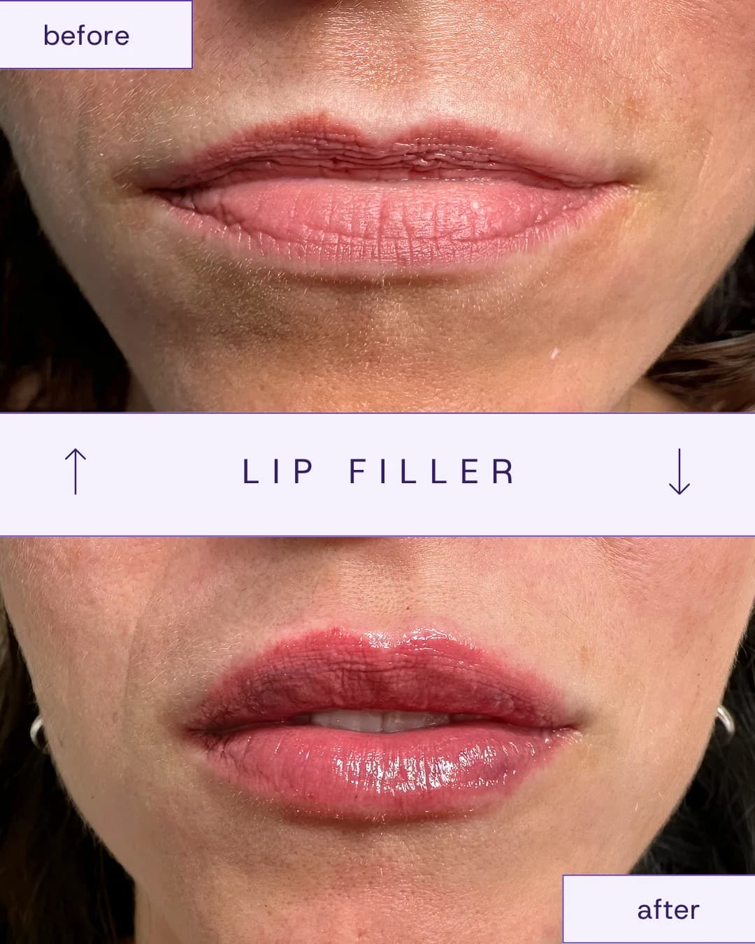 Treatment result