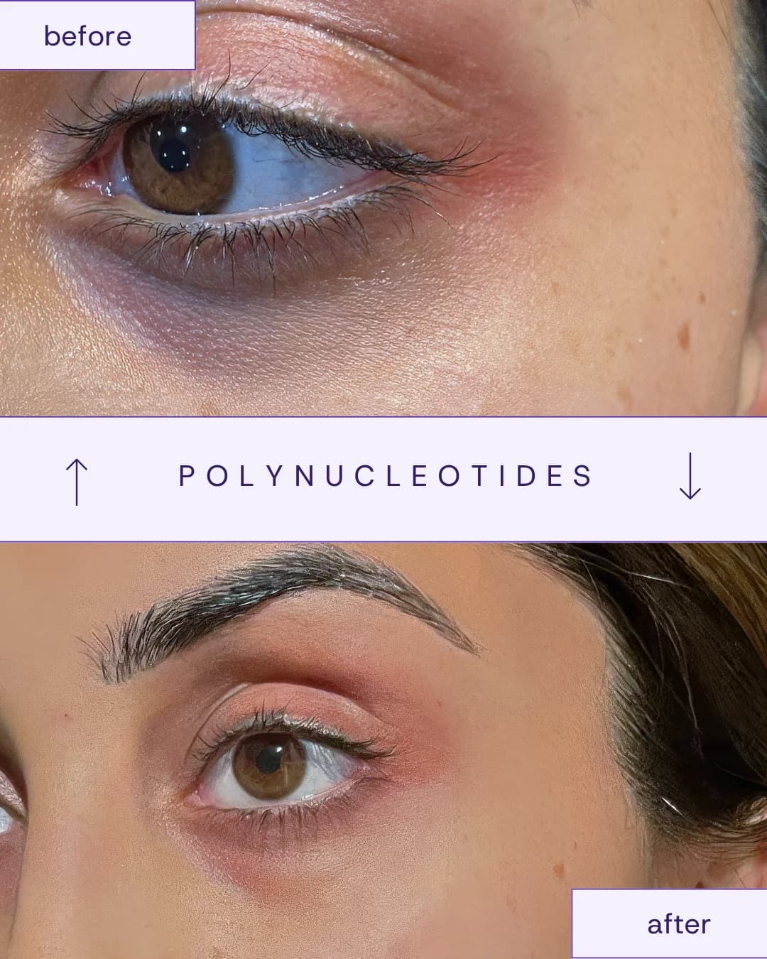 Treatment result