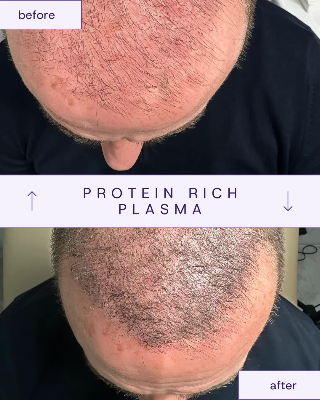 Treatment result